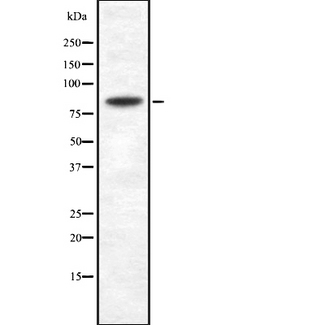 SEMA3A / Semaphorin 3A Antibody - Western blot analysis SEMA3A using Jurkat whole cells lysates