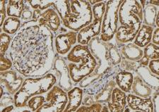 SEMA3A / Semaphorin 3A Antibody - 1:100 staining mouse kidney tissue by IHC-P. The sample was formaldehyde fixed and a heat mediated antigen retrieval step in citrate buffer was performed. The sample was then blocked and incubated with the antibody for 1.5 hours at 22°C. An HRP conjugated goat anti-rabbit antibody was used as the secondary.