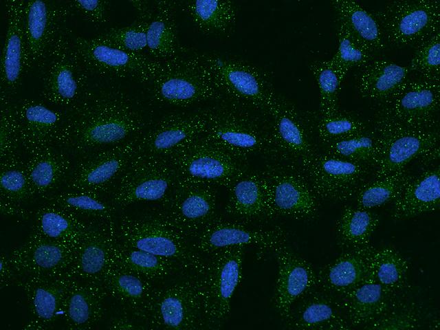 SEMA3A / Semaphorin 3A Antibody - Immunofluorescence staining of SEMA3A in U2OS cells. Cells were fixed with 4% PFA, permeabilzed with 0.1% Triton X-100 in PBS, blocked with 10% serum, and incubated with rabbit anti-Human SEMA3A polyclonal antibody (dilution ratio 1:200) at 4°C overnight. Then cells were stained with the Alexa Fluor 488-conjugated Goat Anti-rabbit IgG secondary antibody (green) and counterstained with DAPI (blue). Positive staining was localized to Cytoplasm.