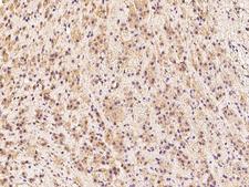 SEMA3A / Semaphorin 3A Antibody - Immunochemical staining of human SEMA3A in human adrenal gland with rabbit polyclonal antibody at 1:100 dilution, formalin-fixed paraffin embedded sections.