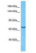 SEMA3B / SemA Antibody - SEMA3B / SemA antibody Western Blot of HepG2. Antibody dilution: 1 ug/ml.  This image was taken for the unconjugated form of this product. Other forms have not been tested.