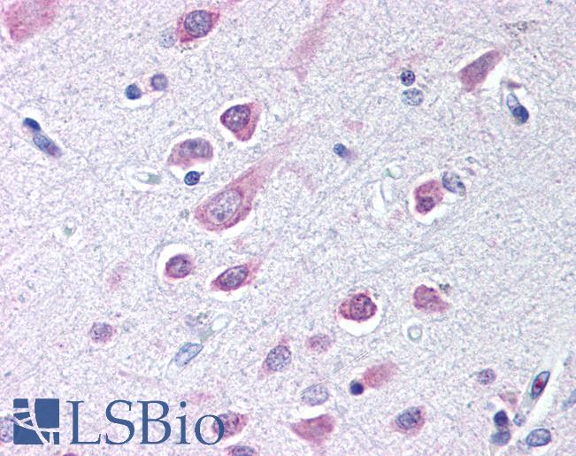 SEMA3B / SemA Antibody - Anti-SEMA3B antibody IHC of human brain, cortex. Immunohistochemistry of formalin-fixed, paraffin-embedded tissue after heat-induced antigen retrieval. Antibody concentration 10 ug/ml.  This image was taken for the unconjugated form of this product. Other forms have not been tested.
