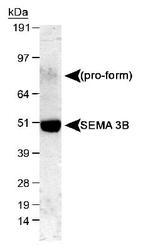 SEMA3B / SemA Antibody - Detection of SEMA 3B in mouse E16 cerebellum lysate. ECL exposure, 1 minute.  This image was taken for the unconjugated form of this product. Other forms have not been tested.