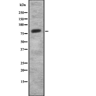 SEMA3C / Semaphorin 3C Antibody - Western blot analysis SEMA3C using Jurkat whole cells lysates