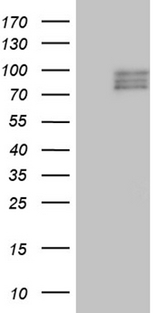 SEMA3D / Semaphorin 3D Antibody - HEK293T cells were transfected with the pCMV6-ENTRY control. (Left lane) or pCMV6-ENTRY SEMA3D. (Right lane) cDNA for 48 hrs and lysed. Equivalent amounts of cell lysates. (5 ug per lane) were separated by SDS-PAGE and immunoblotted with anti-SEMA3D. (1:500)