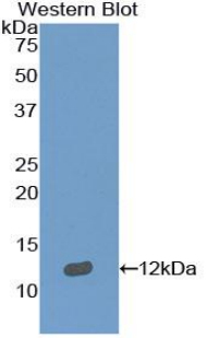 SEMA3E / Semaphorin 3E Antibody - Western blot of recombinant Semaphorin 3E / SEMA3E.  This image was taken for the unconjugated form of this product. Other forms have not been tested.