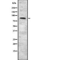 SEMA3F / Semaphorin 3F Antibody - Western blot analysis SEMA3F using COLO205 whole cells lysates