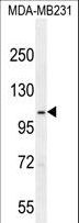 SEMA3G / Semaphorin 3G Antibody - SEMA3G Antibody western blot of MDA-MB231 cell line lysates (35 ug/lane). The SEMA3G antibody detected the SEMA3G protein (arrow).