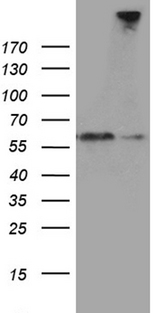 SEMA3G / Semaphorin 3G Antibody - HEK293T cells were transfected with the pCMV6-ENTRY control. (Left lane) or pCMV6-ENTRY SEMA3G. (Right lane) cDNA for 48 hrs and lysed. Equivalent amounts of cell lysates. (5 ug per lane) were separated by SDS-PAGE and immunoblotted with anti-SEMA3G. (1:2000)