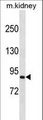 SEMA4A / Semaphorin 4A Antibody - SEMA4A Antibody western blot of mouse kidney tissue lysates (35 ug/lane). The SEMA4A antibody detected the SEMA4A protein (arrow).