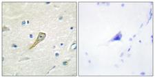 SEMA4A / Semaphorin 4A Antibody - Immunohistochemistry analysis of paraffin-embedded human brain tissue, using SEMA4A Antibody. The picture on the right is blocked with the synthesized peptide.