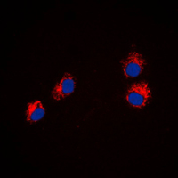 SEMA4A / Semaphorin 4A Antibody - Immunofluorescent analysis of Semaphorin 4A staining in HeLa cells. Formalin-fixed cells were permeabilized with 0.1% Triton X-100 in TBS for 5-10 minutes and blocked with 3% BSA-PBS for 30 minutes at room temperature. Cells were probed with the primary antibody in 3% BSA-PBS and incubated overnight at 4 C in a humidified chamber. Cells were washed with PBST and incubated with a DyLight 594-conjugated secondary antibody (red) in PBS at room temperature in the dark. DAPI was used to stain the cell nuclei (blue).