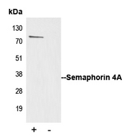 SEMA4A / Semaphorin 4A Antibody - Immunoprecipitation of Semaphorin 4A from 0.5mg Jurkat whole cell extract lysate using 5ug of Anti-Semaphorin 4A Antibody and 50ul of protein G magnetic beads (+). No antibody was added to the control (-). The antibody was incubated under agitation with Protein G beads for 10min Jurkat whole cell extract lysate diluted in RIPA buffer was added to each sample and incubated for a further 10min under agitation. Proteins were eluted by addition of 40ul SDS loading buffer and incubated for 10min at 70 C; 10ul of each sample was separated on a SDS PAGE gel transferred to a nitrocellulose membrane blocked with 5% BSA and probed with Anti-Semaphorin 4A Antibody.