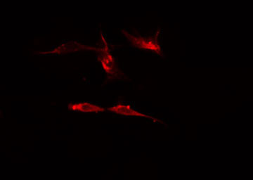 SEMA4A / Semaphorin 4A Antibody - Staining HeLa cells by IF/ICC. The samples were fixed with PFA and permeabilized in 0.1% Triton X-100, then blocked in 10% serum for 45 min at 25°C. The primary antibody was diluted at 1:200 and incubated with the sample for 1 hour at 37°C. An Alexa Fluor 594 conjugated goat anti-rabbit IgG (H+L) antibody, diluted at 1/600, was used as secondary antibody.