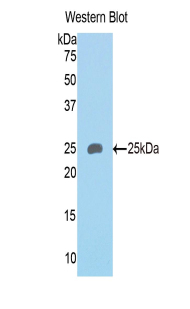 SEMA4B / Semaphorin 4B Antibody - Western blot of recombinant SEMA4B.