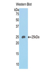 SEMA4B / Semaphorin 4B Antibody - Western blot of recombinant SEMA4B.