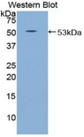 SEMA4B / Semaphorin 4B Antibody - Western blot of recombinant SEMA4B.  This image was taken for the unconjugated form of this product. Other forms have not been tested.