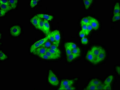 SEMA4B / Semaphorin 4B Antibody - Immunofluorescence staining of HepG2 cells with SEMA4B Antibody at 1:100, counter-stained with DAPI. The cells were fixed in 4% formaldehyde, permeabilized using 0.2% Triton X-100 and blocked in 10% normal Goat Serum. The cells were then incubated with the antibody overnight at 4°C. The secondary antibody was Alexa Fluor 488-congugated AffiniPure Goat Anti-Rabbit IgG(H+L).
