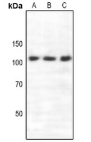 SEMA4C / Semaphorin 4C Antibody - Western blot analysis of Semaphorin 4C expression in A549 (A), mouse brain (B), rat brain (C) whole cell lysates.