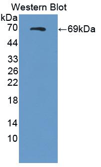 SEMA4D / Semaphorin 4D / CD100 Antibody - Western blot of SEMA4D / Semaphorin 4D / CD100 antibody.