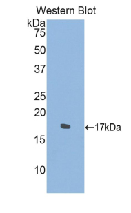 SEMA4D / Semaphorin 4D / CD100 Antibody - Western blot of SEMA4D / Semaphorin 4D / CD100 antibody.