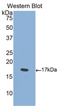 SEMA4D / Semaphorin 4D / CD100 Antibody - Western blot of SEMA4D / Semaphorin 4D / CD100 antibody.