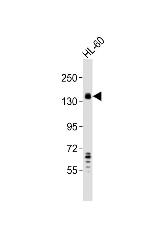SEMA4D / Semaphorin 4D / CD100 Antibody - Anti-SEMA4D Antibody at 1:2000 dilution + HL-60 whole cell lysates Lysates/proteins at 20 ug per lane. Secondary Goat Anti-Rabbit IgG, (H+L), Peroxidase conjugated at 1/10000 dilution Predicted band size : 96 kDa Blocking/Dilution buffer: 5% NFDM/TBST.