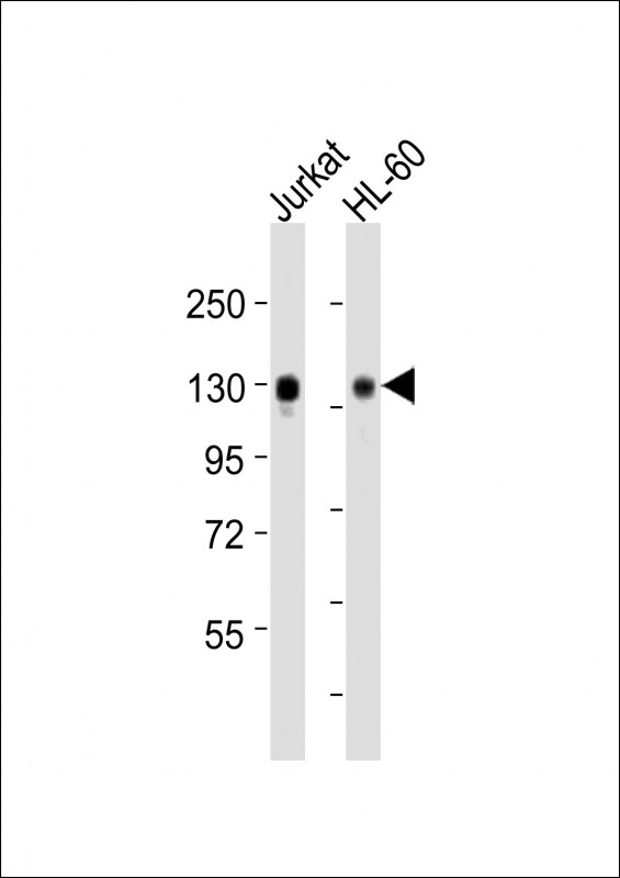 SEMA4D / Semaphorin 4D / CD100 Antibody - All lanes : Anti-SEMA4D Antibody at 1:2000 dilution Lane 1: Jurkat whole cell lysates Lane 2: HL-60 whole cell lysates Lysates/proteins at 20 ug per lane. Secondary Goat Anti-Rabbit IgG, (H+L), Peroxidase conjugated at 1/10000 dilution Predicted band size : 96 kDa Blocking/Dilution buffer: 5% NFDM/TBST.