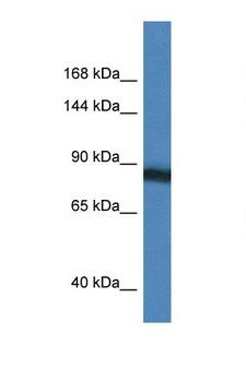 SEMA4D / Semaphorin 4D / CD100 Antibody - SEMA4D / CD100 antibody Western blot of HeLa Cell lysate. Antibody concentration 1 ug/ml.  This image was taken for the unconjugated form of this product. Other forms have not been tested.