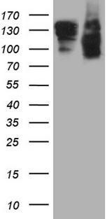 SEMA4D / Semaphorin 4D / CD100 Antibody - HEK293T cells were transfected with the pCMV6-ENTRY control. (Left lane) or pCMV6-ENTRY SEMA4D. (Right lane) cDNA for 48 hrs and lysed. Equivalent amounts of cell lysates. (5 ug per lane) were separated by SDS-PAGE and immunoblotted with anti-SEMA4D. (1:2000)