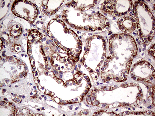 SEMA4D / Semaphorin 4D / CD100 Antibody - Immunohistochemical staining of paraffin-embedded Human Kidney tissue within the normal limits using anti-SEMA4D mouse monoclonal antibody. (Heat-induced epitope retrieval by 1mM EDTA in 10mM Tris buffer. (pH8.5) at 120°C for 3 min. (1:500)