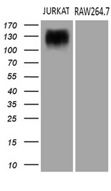SEMA4D / Semaphorin 4D / CD100 Antibody - Western blot analysis of extracts. (35ug) from 2 different cell lines by using anti-SEMA4D monoclonal antibody. (1:500)