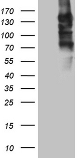 SEMA4D / Semaphorin 4D / CD100 Antibody - HEK293T cells were transfected with the pCMV6-ENTRY control. (Left lane) or pCMV6-ENTRY SEMA4D. (Right lane) cDNA for 48 hrs and lysed