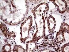 SEMA4D / Semaphorin 4D / CD100 Antibody - Immunohistochemical staining of paraffin-embedded Human Kidney tissue within the normal limits using anti-SEMA4D mouse monoclonal antibody. (Heat-induced epitope retrieval by 1mM EDTA in 10mM Tris buffer. (pH8.5) at 120°C for 3 min. (1:2000)