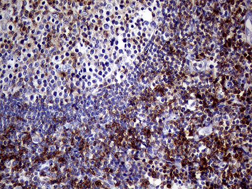 SEMA4D / Semaphorin 4D / CD100 Antibody - Immunohistochemical staining of paraffin-embedded Human lymph node tissue within the normal limits using anti-SEMA4D mouse monoclonal antibody. (Heat-induced epitope retrieval by 1mM EDTA in 10mM Tris buffer. (pH8.5) at 120°C for 3 min. (1:500)