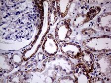 SEMA4D / Semaphorin 4D / CD100 Antibody - Immunohistochemical staining of paraffin-embedded Human Kidney tissue within the normal limits using anti-SEMA4D mouse monoclonal antibody. (Heat-induced epitope retrieval by 1mM EDTA in 10mM Tris buffer. (pH8.5) at 120°C for 3 min. (1:1000)