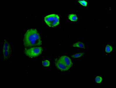 SEMA4D / Semaphorin 4D / CD100 Antibody - Immunofluorescence staining of MCF-7 cells diluted at 1:166, counter-stained with DAPI. The cells were fixed in 4% formaldehyde, permeabilized using 0.2% Triton X-100 and blocked in 10% normal Goat Serum. The cells were then incubated with the antibody overnight at 4°C.The Secondary antibody was Alexa Fluor 488-congugated AffiniPure Goat Anti-Rabbit IgG (H+L).