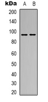 SEMA4D / Semaphorin 4D / CD100 Antibody - Western blot analysis of CD100 expression in MCF7 (A); L929 (B) whole cell lysates.