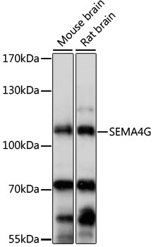 SEMA4G / Semaphorin 4G Antibody - Western blot analysis of extracts of various cell lines, using SEMA4G antibody at 1:1000 dilution. The secondary antibody used was an HRP Goat Anti-Rabbit IgG (H+L) at 1:10000 dilution. Lysates were loaded 25ug per lane and 3% nonfat dry milk in TBST was used for blocking. An ECL Kit was used for detection and the exposure time was 5s.