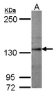SEMA5A / Semaphorin 5A Antibody - Sample (50 ug of whole cell lysate) A: mouse brain 5% SDS PAGE SEMA5A antibody diluted at 1:1000