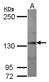 SEMA5A / Semaphorin 5A Antibody - Sample (50 ug of whole cell lysate) A: mouse brain 5% SDS PAGE SEMA5A antibody diluted at 1:1000