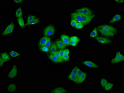 SEMA5A / Semaphorin 5A Antibody - Immunofluorescence staining of HepG2 cells with SEMA5A Antibody at 1:400, counter-stained with DAPI. The cells were fixed in 4% formaldehyde, permeabilized using 0.2% Triton X-100 and blocked in 10% normal Goat Serum. The cells were then incubated with the antibody overnight at 4°C. The secondary antibody was Alexa Fluor 488-congugated AffiniPure Goat Anti-Rabbit IgG(H+L).