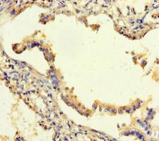 SEMA5A / Semaphorin 5A Antibody - Immunohistochemistry of paraffin-embedded human lung tissue using SEMA5A Antibody at dilution of 1:100