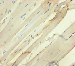 SEMA5A / Semaphorin 5A Antibody - Immunohistochemistry of paraffin-embedded human skeletal muscle tissue using SEMA5A Antibody at dilution of 1:100