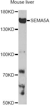 SEMA5A / Semaphorin 5A Antibody - Western blot analysis of extracts of mouse liver, using SEMA5A antibody at 1:1000 dilution. The secondary antibody used was an HRP Goat Anti-Rabbit IgG (H+L) at 1:10000 dilution. Lysates were loaded 25ug per lane and 3% nonfat dry milk in TBST was used for blocking. An ECL Kit was used for detection and the exposure time was 3min.