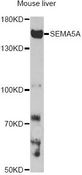 SEMA5A / Semaphorin 5A Antibody - Western blot analysis of extracts of mouse liver, using SEMA5A antibody at 1:1000 dilution. The secondary antibody used was an HRP Goat Anti-Rabbit IgG (H+L) at 1:10000 dilution. Lysates were loaded 25ug per lane and 3% nonfat dry milk in TBST was used for blocking. An ECL Kit was used for detection and the exposure time was 3min.