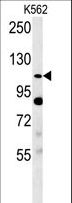 SEMA5A / Semaphorin 5A Antibody - Semaphorin 5A-S106 Antibody western blot of K562 cell line lysates (35 ug/lane). The Semaphorin 5A antibody detected the Semaphorin 5A protein (arrow).