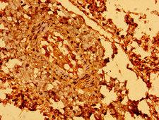SEMA5B / Semaphorin 5B Antibody - Immunohistochemistry image of paraffin-embedded human lung tissue at a dilution of 1:100