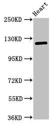 SEMA5B / Semaphorin 5B Antibody - Positive Western Blot detected in Mouse heart tissue. All lanes: SEMA5B antibody at 1 µg/ml Secondary Goat polyclonal to rabbit IgG at 1/50000 dilution. Predicted band size: 126, 120, 124, 132 KDa. Observed band size: 126 KDa