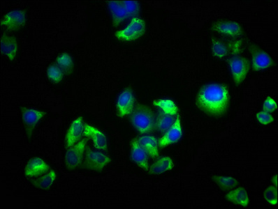 SEMA5B / Semaphorin 5B Antibody - Immunofluorescence staining of Hela cells with SEMA5B Antibody at 1:33, counter-stained with DAPI. The cells were fixed in 4% formaldehyde, permeabilized using 0.2% Triton X-100 and blocked in 10% normal Goat Serum. The cells were then incubated with the antibody overnight at 4°C. The secondary antibody was Alexa Fluor 488-congugated AffiniPure Goat Anti-Rabbit IgG(H+L).